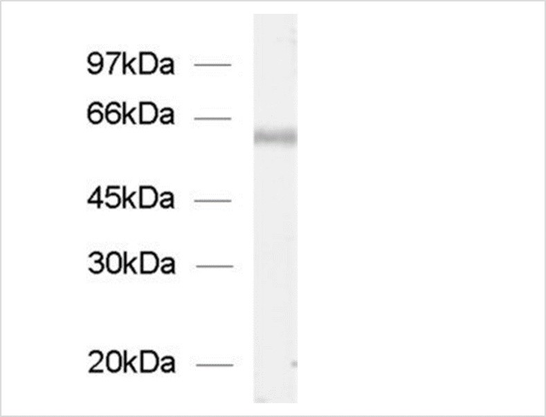 抗ChT(SLC5A7)抗体を用いたWB像